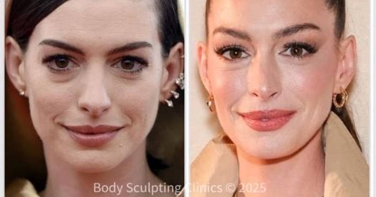 Before and After Scrutinizing Anne Hathaway S Changing Look Across The
