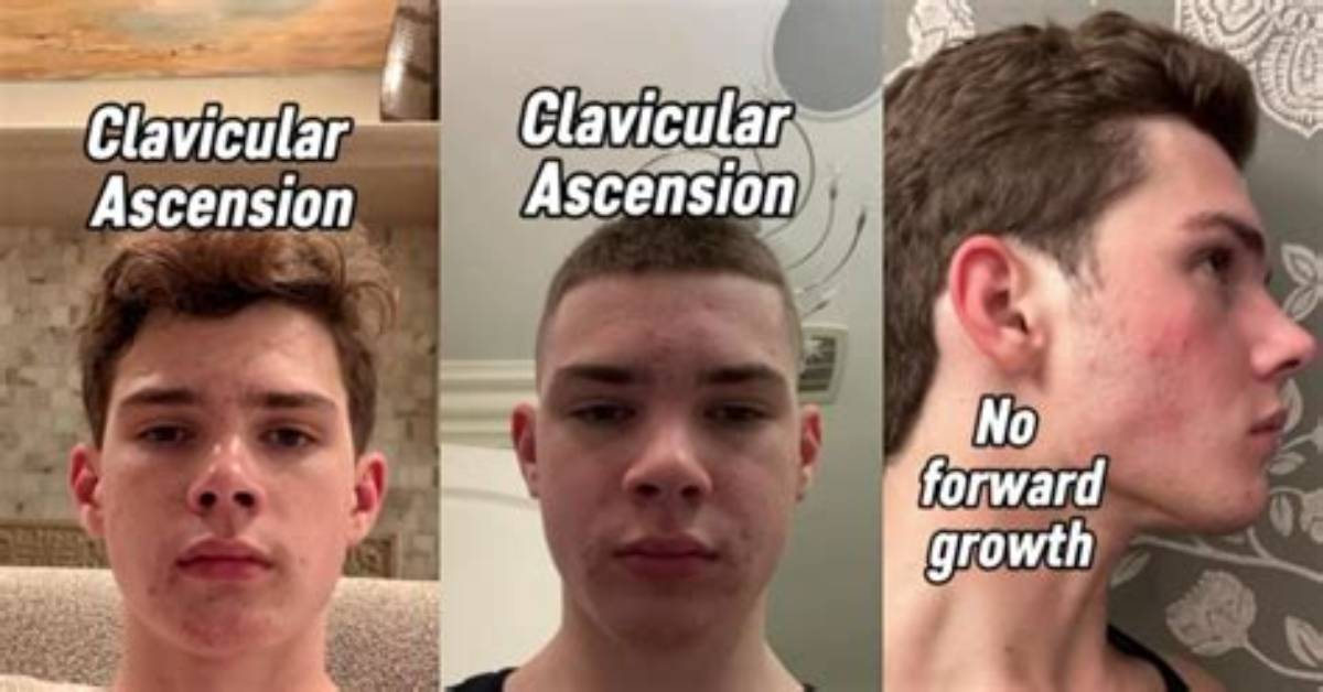 Clavicular Age Breakdown Chronology of the 20 Year Old Creator S Rise Sponsor Clash And