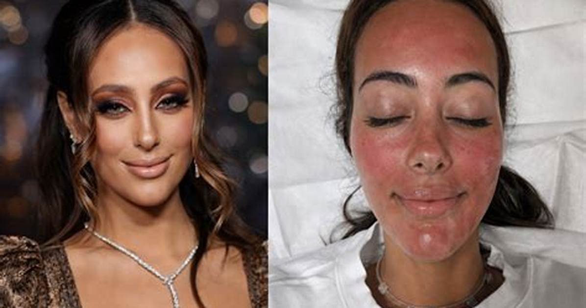 Emira D Spain Before and After Inside Her Transformative Rise And