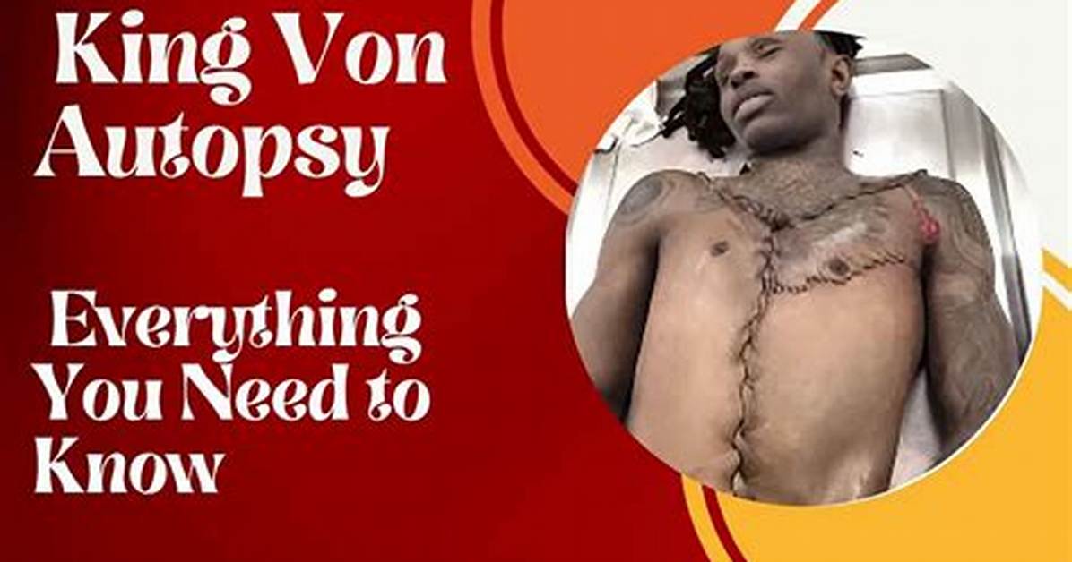 Fact Checking King Von S Autopsy Addressing Viral Reddit Rumors And