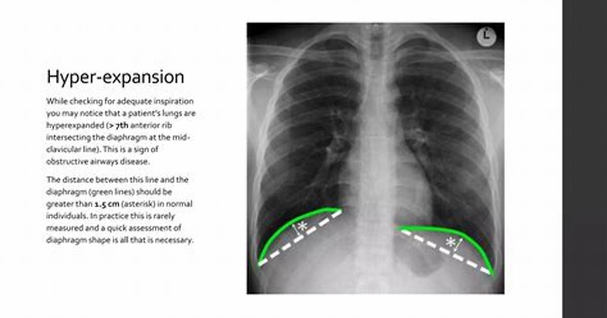How Tall Is Clavicular Fact Checking Rumors Claims And