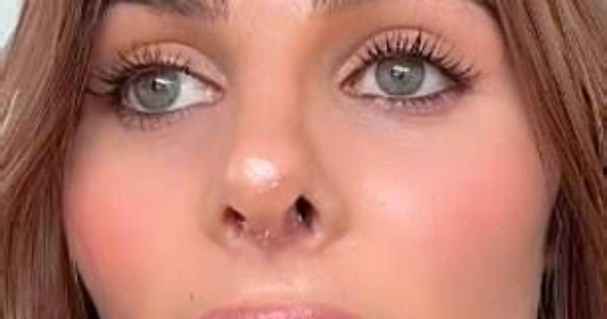 How the Indy Clinton Nose Job Debate Exploded Across