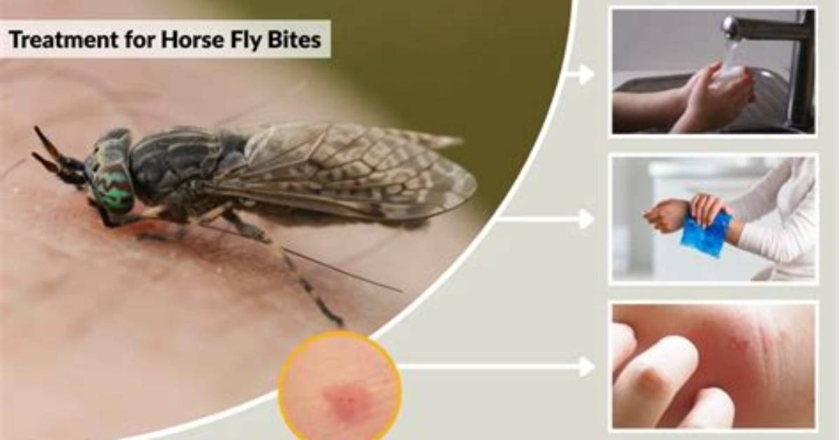 How to Treat a Horsefly Bite Complete Relief Guide Home Remedies And