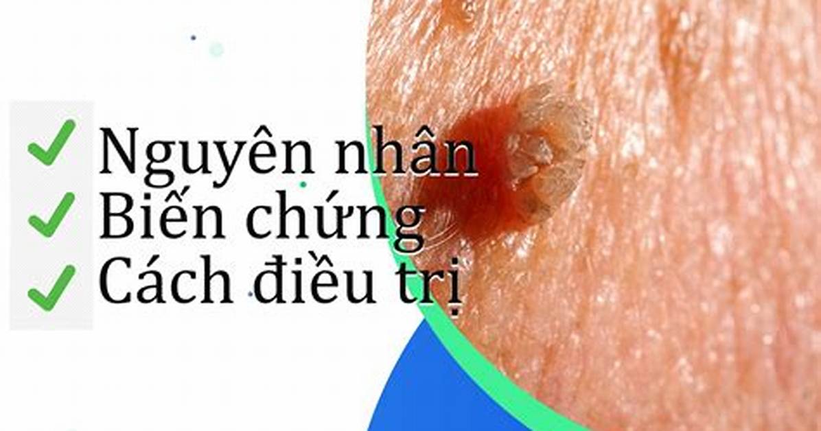Mao Ga Jimaru Yin
