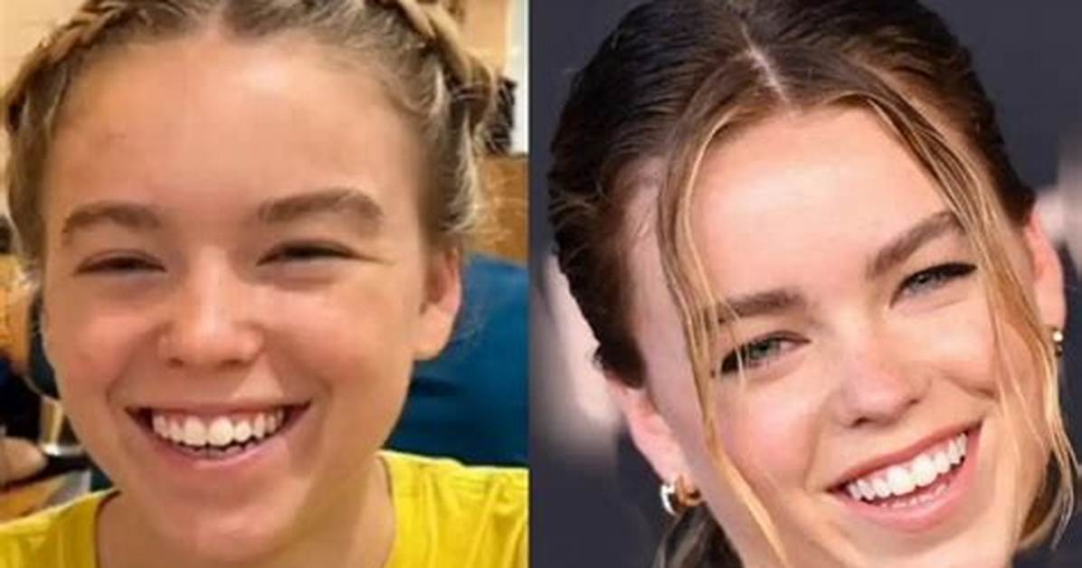Milly Alcock Teeth Discourse Explained What Happened Who Reacted and Why It