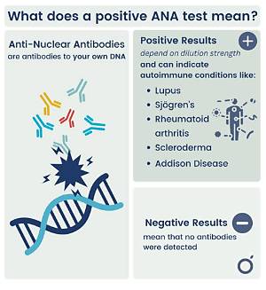 Positive Ana Test Meaning: Why a Pos Ana Result Does Not Always Mean Lupus
