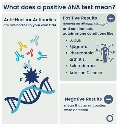 Positive Ana Test Meaning: Why a Pos Ana Result Does Not Always Mean Lupus
