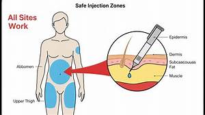Stomach Vs. Thigh Vs. Arm: What the Clinical Data Really Says About Wegovy Injection Sites