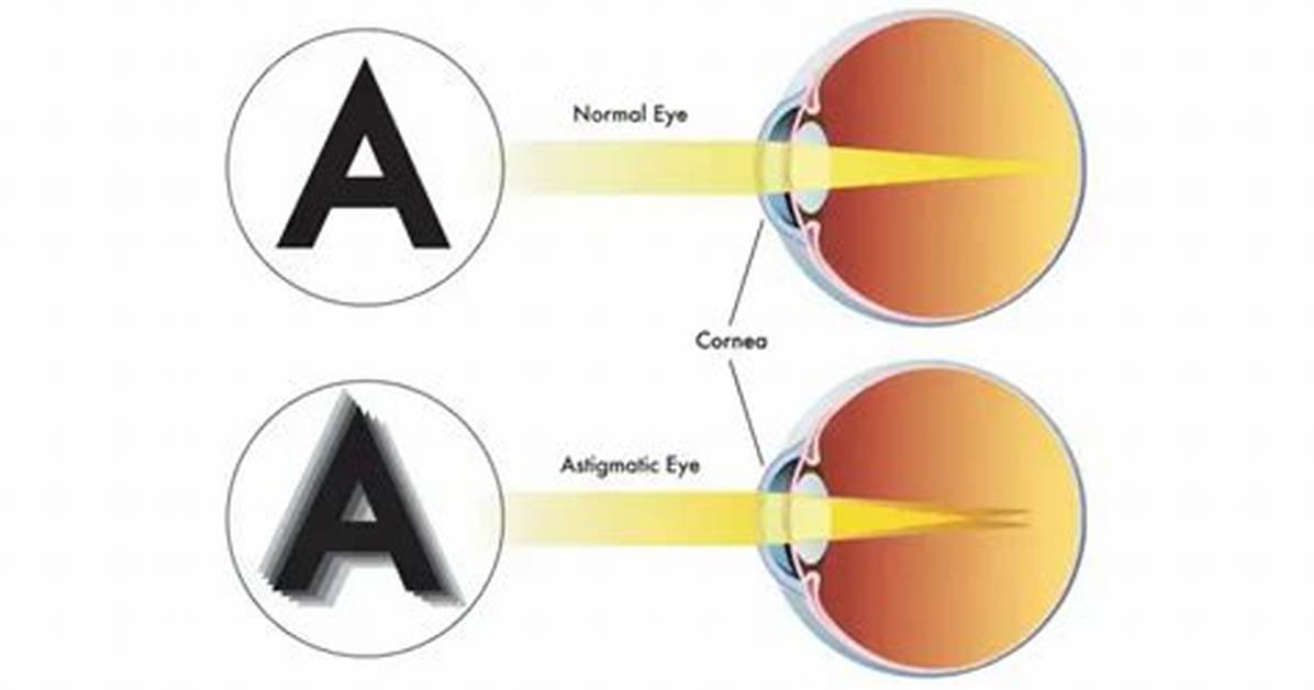 The Complete Guide to Conquering Astigmatism Glare Night Driving Tips Lenses And