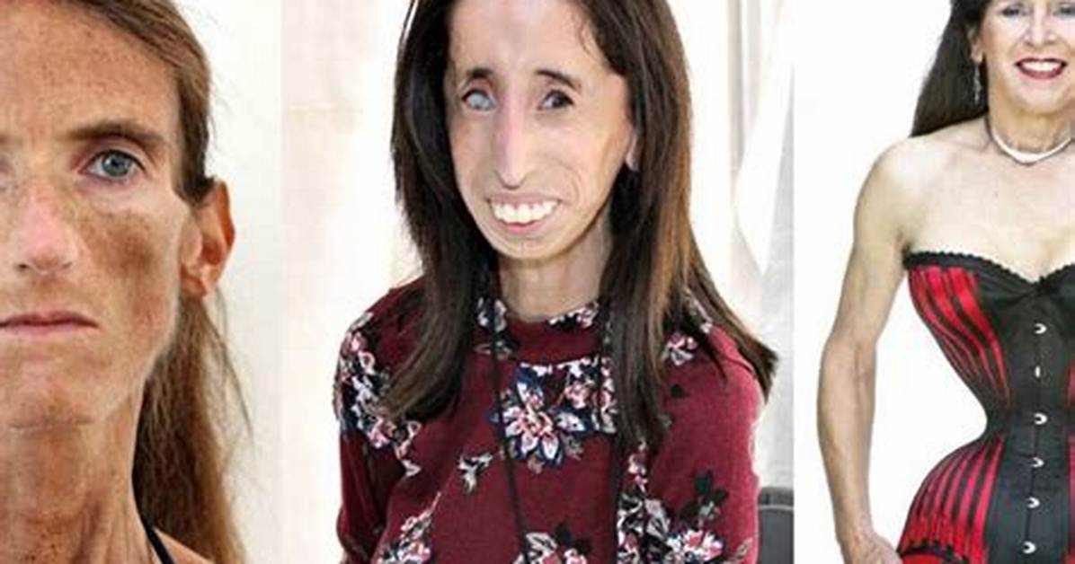 The World S Skinniest Person Debunking Internet Hoaxes and Examining The