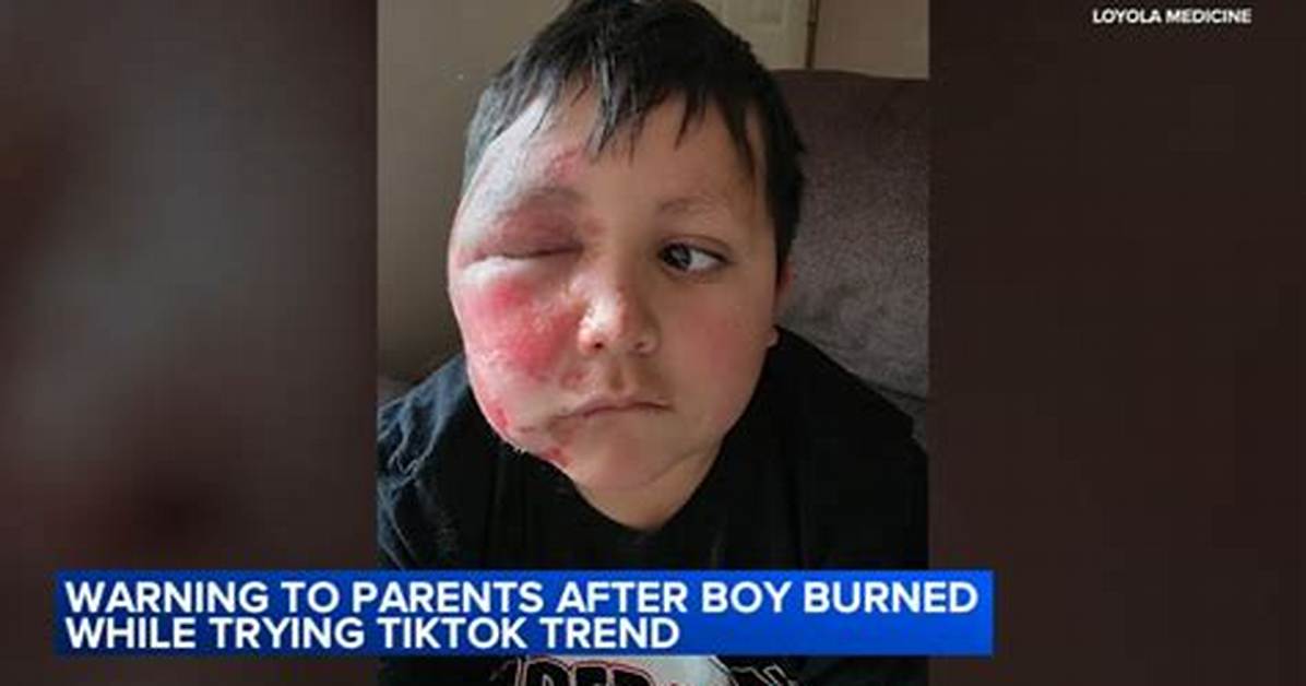Tiktok Burned