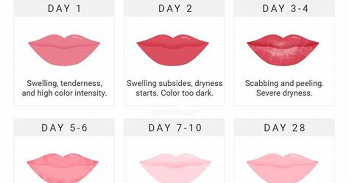 Timeline of a Lip Blemish Day by Day Stages from Early Itch To