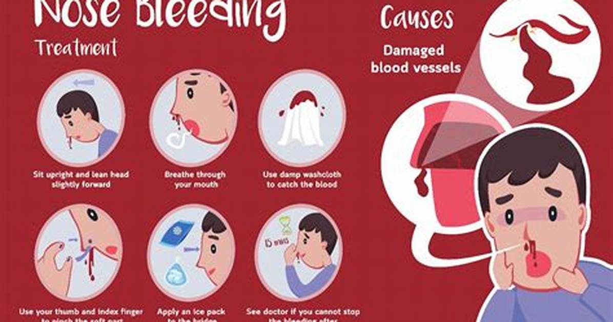 Why Never Having a Nosebleed Is Surging Online the Viral Debate Over